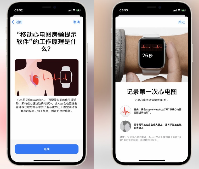 iOS15.2正式版终于来了（经本人亲测值得升级）