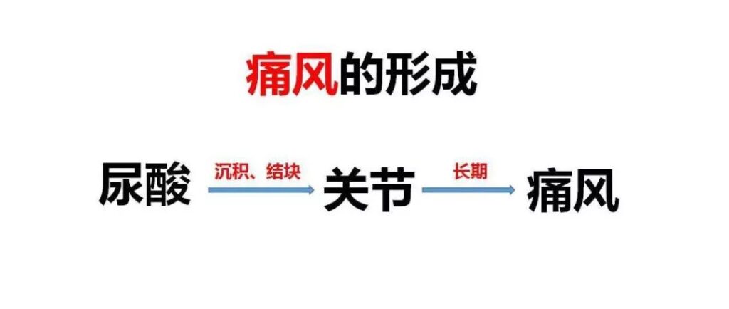 什么坏习惯会导致痛风_坏习惯与痛风间有多大的关系