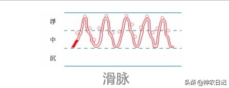 古代如何诊断喜脉_中医如何把脉的