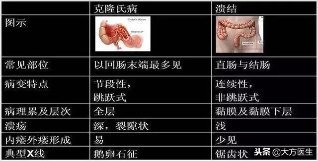 导致大肠癌的原因是什么(了解大肠癌发病的4种原因)