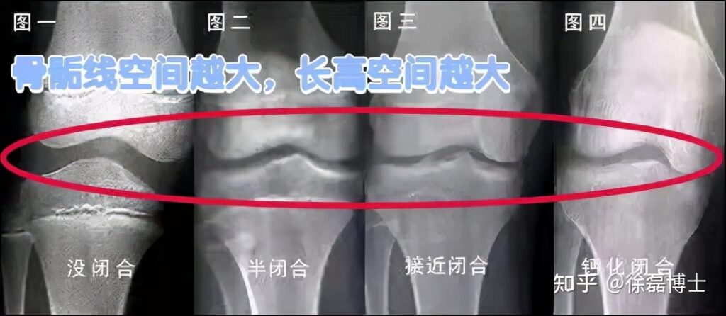 儿童怎样长高最快最有效_12岁儿童增高最有效方法