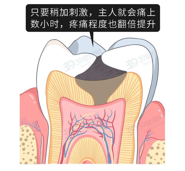 护理牙齿的方法有哪些_日常护理牙齿的三个方法