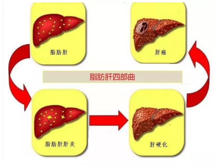 张文宏谈不明原因儿童肝炎