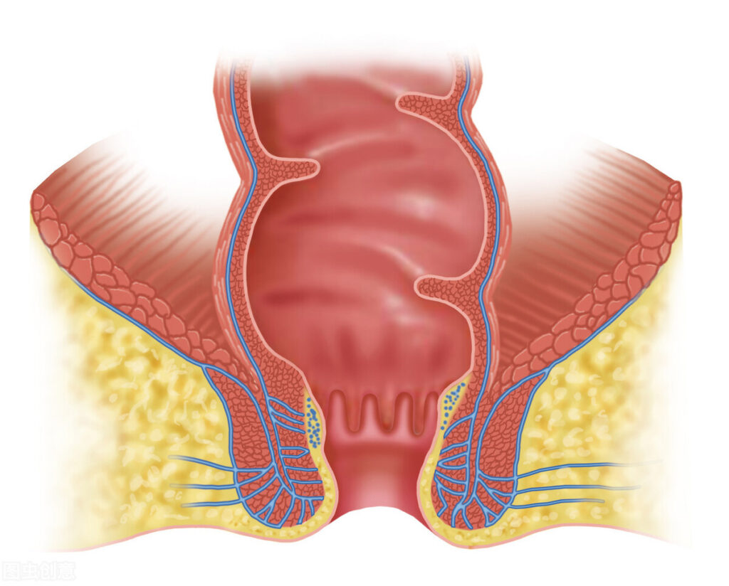 肛裂的发作原因是什么_肛裂的症状有些什么