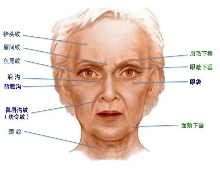 面部年轻化有哪些项目_面部年轻化的方法