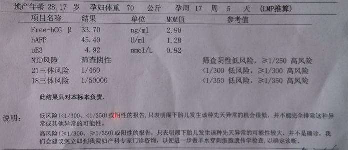 唐筛检查时间(唐筛检查什么时候做最好)