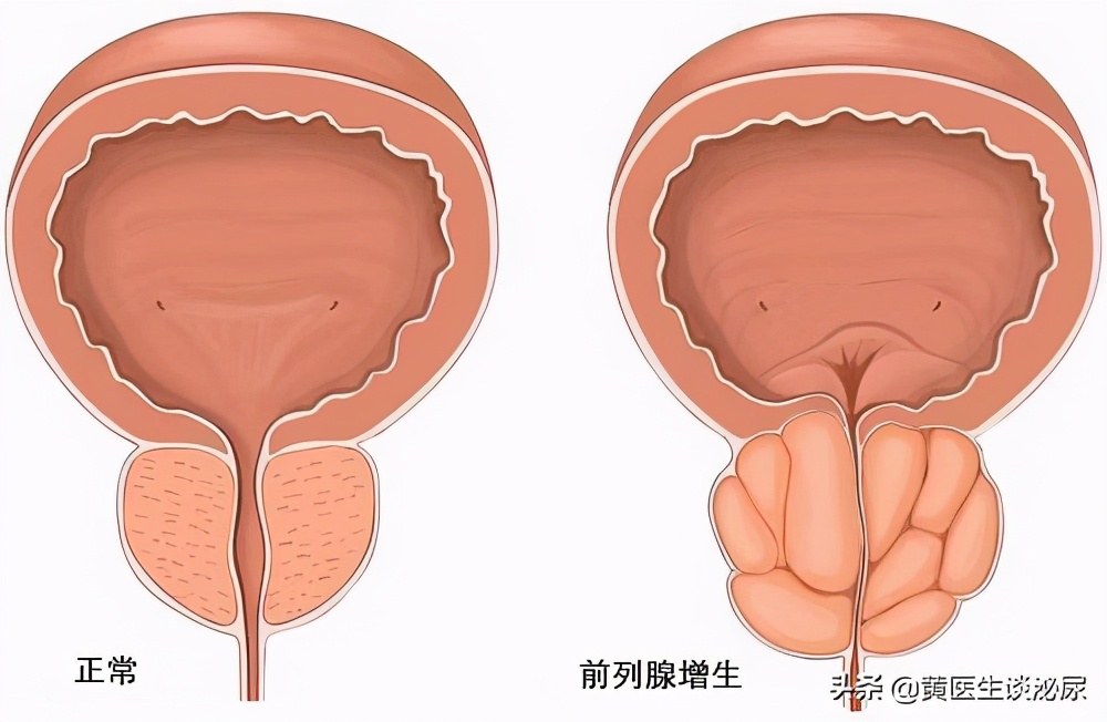 尿频看什么科_尿频一般有哪些原因