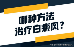 白斑病怎么治愈_白斑病治疗的5种方法