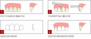 如何刷牙牙白_牙如何刷白