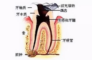 牙齿有点松动怎么办_治疗松动牙齿的方法