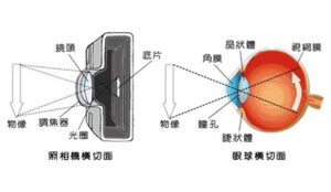 近视的形成原因_缓解近视的三种训练方法