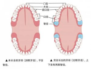 拔智齿什么时间最好_拔智齿的最佳时间段