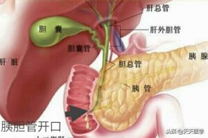 胰腺炎怎么治疗_胰腺炎治疗的方法