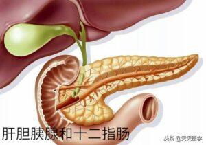 胰腺炎怎么治疗_胰腺炎治疗的方法