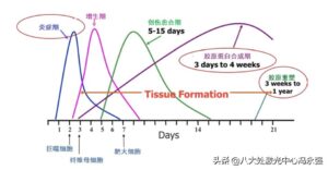 热玛吉是什么美容项目_热玛吉是什么原理