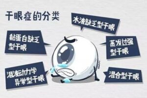 干眼症怎么治疗_干眼症如何预防