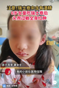 6岁女童吃瑞士卷引起头孢过敏