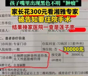 湘雅回应专家将莲子壳诊断为肿瘤