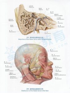 面瘫的发病原因_面瘫的临床表现