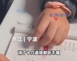 爸爸辅导女儿作业气晕摔断尾椎骨