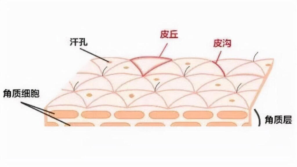 皮肤粗糙是皮肤屏障受损吗_皮肤粗糙怎么改善