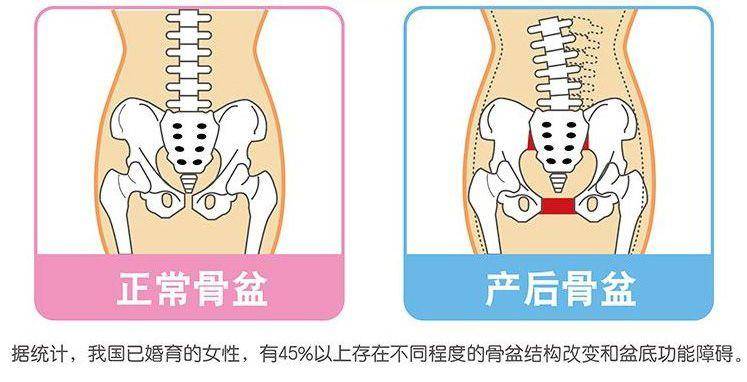 什么是产后尿失禁_产后盆骨不修复有什么危害