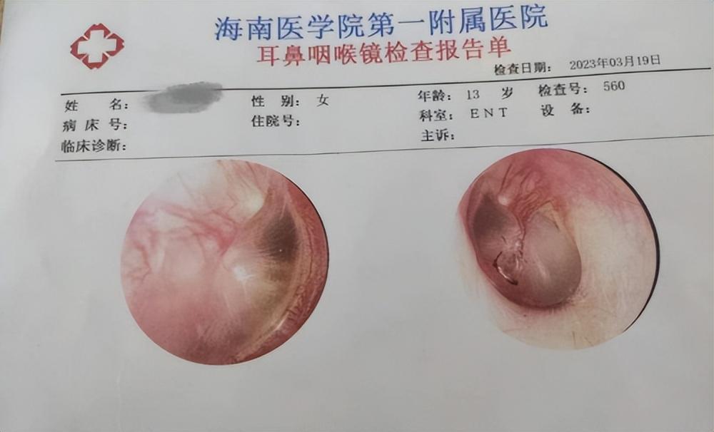 初中生女孩遭霸凌致左耳鼓膜穿孔_如何对付校园霸凌