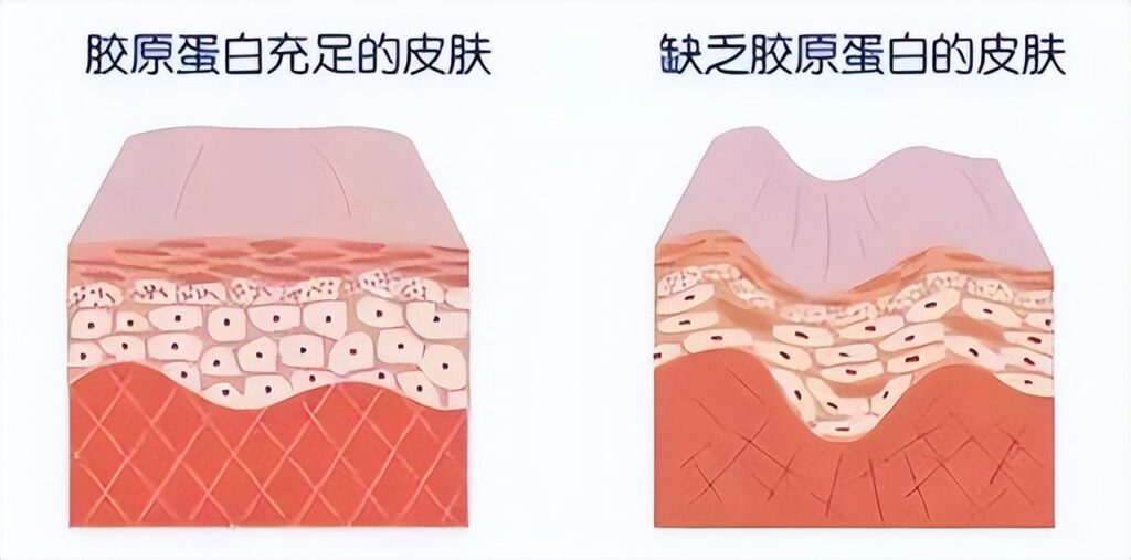 胶原蛋白该怎么补_胶原蛋白的作用和补充