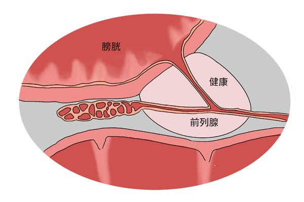 可乐杀精吗_产生精子要多长时间