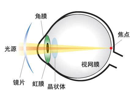 眼睛散光的原因_散光的症状