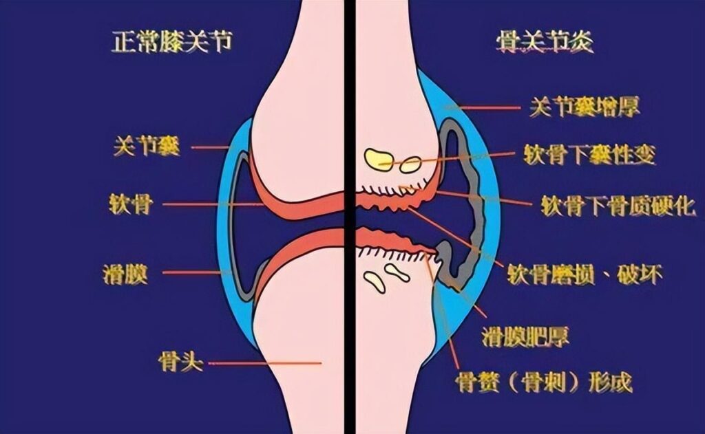 跑步真的伤膝盖吗_这个问题其实很难回答