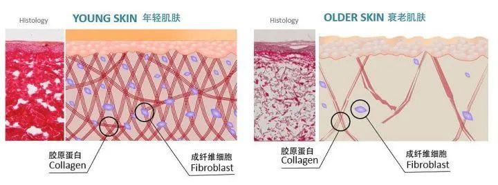 补充胶原蛋白真的有用吗_你怎么看