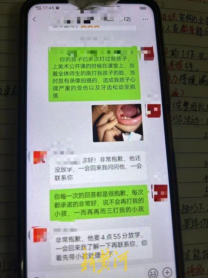 广州一小学生疑遭长期校园霸凌