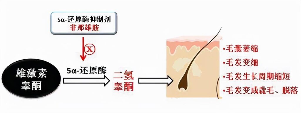 大量脱发怎么办_大量脱发的解决方法