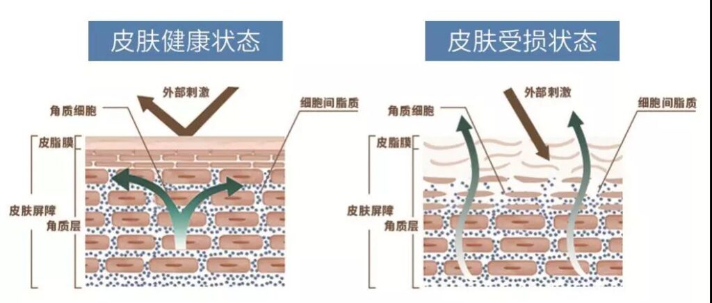 护肤品上脸皮肤刺痛怎么回事_是缺水吗