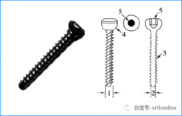 常用的内固定螺钉有哪些，螺钉固定技术