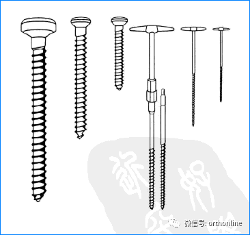 常用的内固定螺钉有哪些，螺钉固定技术