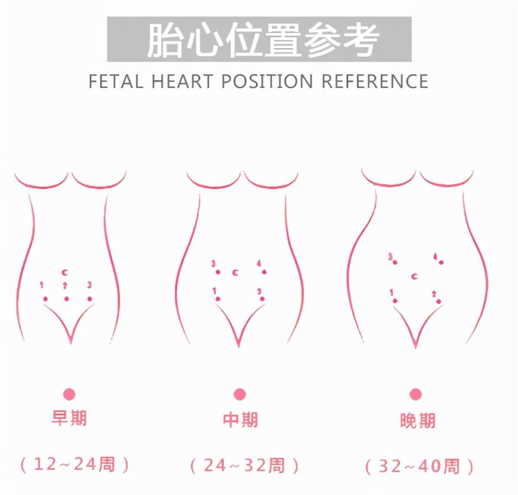 在家怎样用胎心仪测胎心？在家用胎心仪怎么找位置？