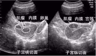 超声检查应不应该喝水？要不要憋尿？