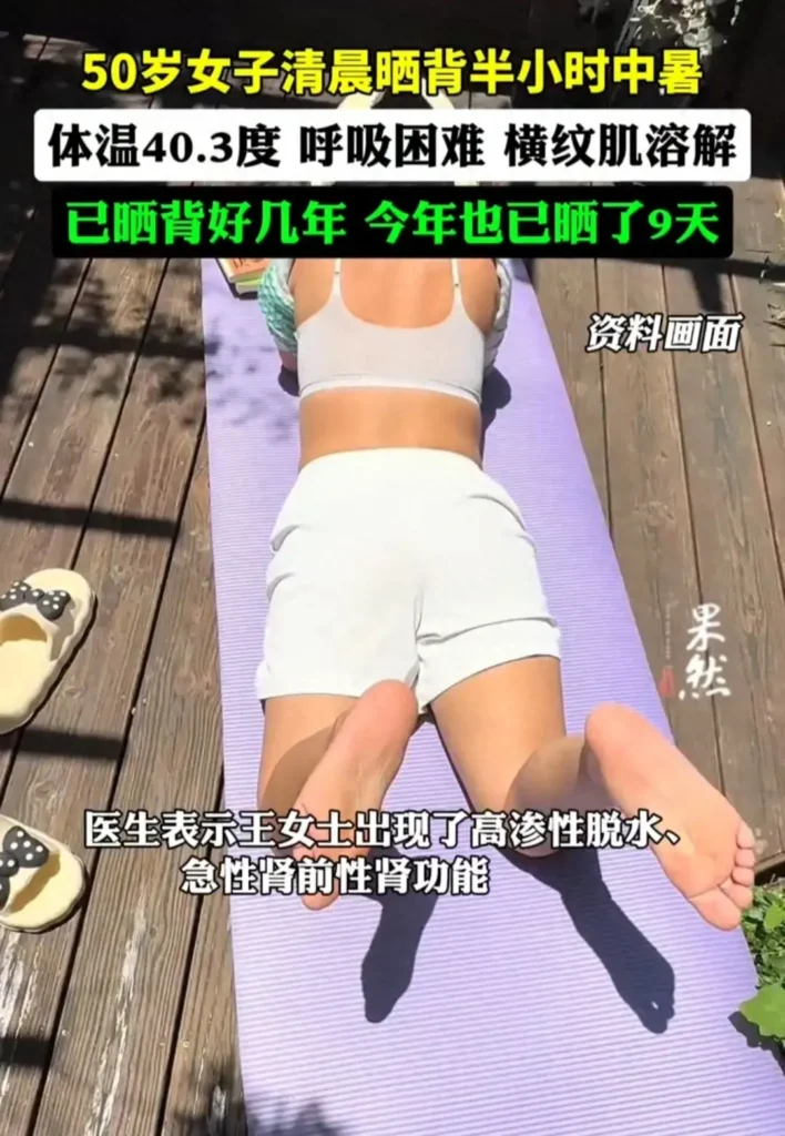 50岁女子晒背半小时中暑，暴晒后中暑怎么办