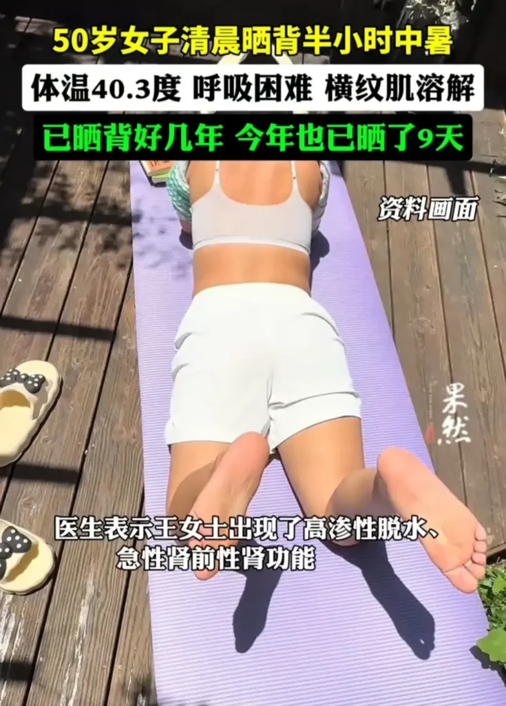 50岁女子晒背半小时中暑，暴晒后中暑怎么办