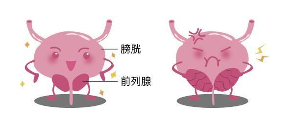 经常憋尿会带来很多危害，甚至危及生命