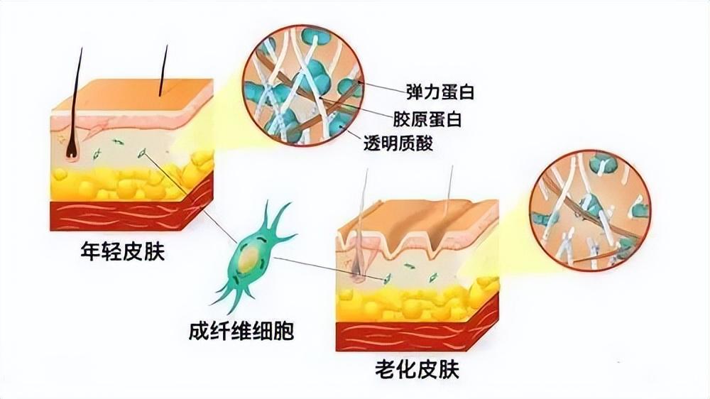 修复受损皮肤组织——水解胶原蛋白