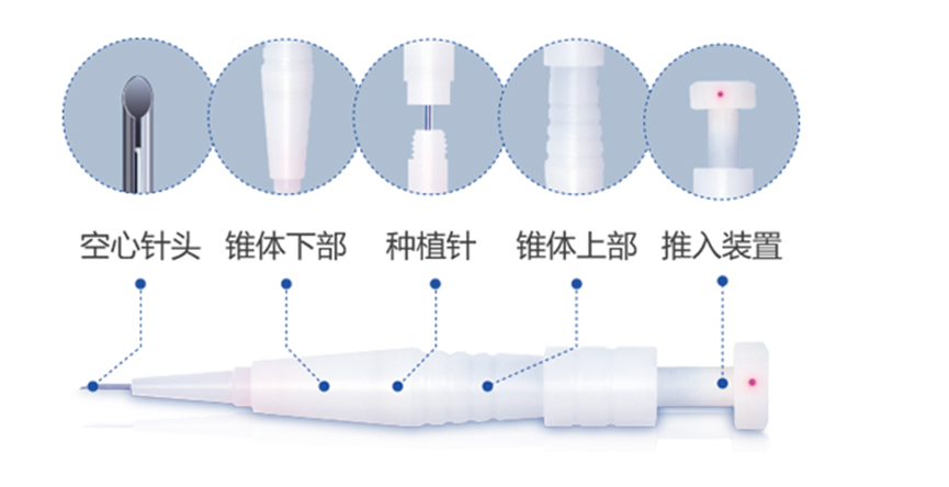 什么植发机构最好最正规