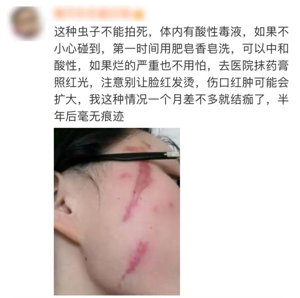 注意！这种飞虫落身上，千万不要随意拍打，可能“毁容”